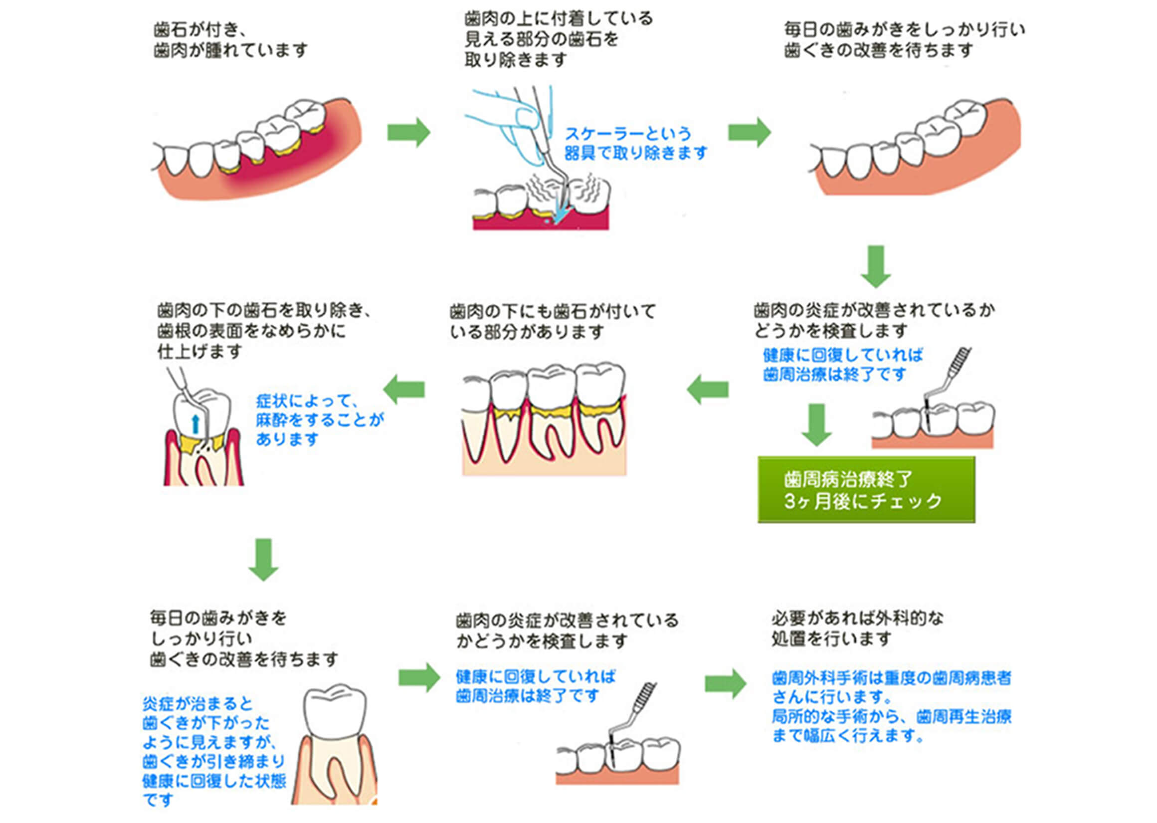 八田歯科での歯周病治療プログラム